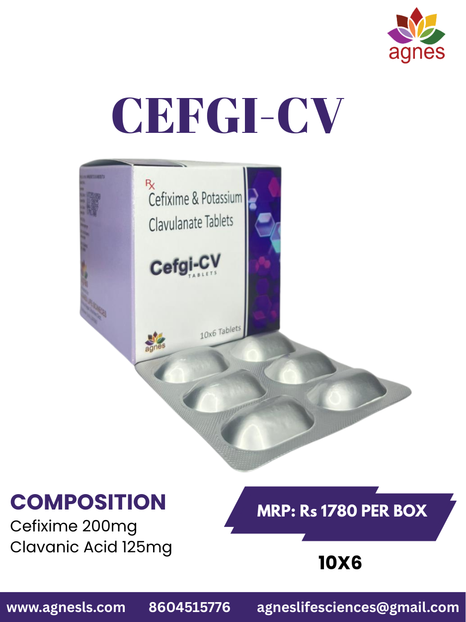 CEFGI-CV